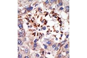 Image no. 2 for anti-Chromobox Homolog 8 (CBX8) (C-Term) antibody (ABIN357753) (CBX8 Antikörper  (C-Term))