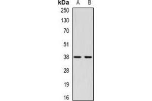 Western blot analysis of CTGF expression in Hela (A), HepG2 (B) whole cell lysates. (CTGF Antikörper)