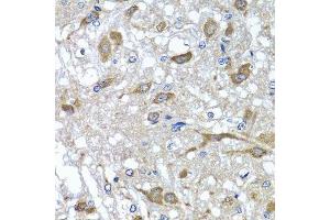 Immunohistochemistry of paraffin-embedded rat brain using OSGEPL1 antibody. (OSGEPL1 Antikörper  (AA 1-270))