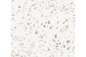 Immunohistochemistry analysis of paraffin-embedded mouse brain using,KCNF1 (ABIN7075155) at dilution of 1: 2400 (KCNF1 Antikörper)