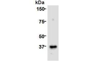 Western Blotting (WB) image for anti-Cell Division Cycle Associated 8 (CDCA8) (AA 1-280), (N-Term) antibody (ABIN1449290)