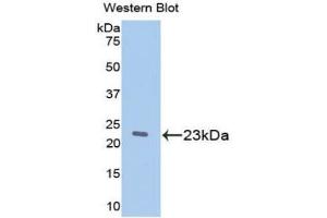 Western blot analysis of the recombinant protein. (Retinol Binding Protein 5 Antikörper  (AA 19-201))