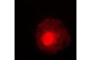 Immunofluorescent analysis of ABL1/2 (pY393/439) staining in HeLa cells. (ABL1/2 Antikörper  (C-Term, pTyr393, pTyr439))