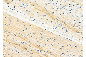 ABIN6265404 and ABIN6273174 at 1/100 staining Rat heart tissue by IHC-P. (Syntaxin 16 Antikörper  (N-Term))
