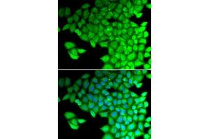 Immunofluorescence analysis of HeLa cells using MYL2 antibody. (MYL2 Antikörper  (AA 1-166))