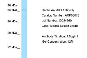 Western Blotting (WB) image for anti-SKI-Like Oncogene (SKIL) (C-Term) antibody (ABIN2787538) (SKIL Antikörper  (C-Term))