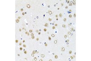 Immunohistochemistry of paraffin-embedded rat brain using RAB3IP antibody at dilution of 1:100 (x40 lens). (RAB3IP Antikörper)