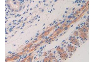 Used in DAB staining on fromalin fixed paraffin- embedded kidney tissue (IL11RA Antikörper  (AA 59-217))