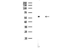 Western blot analysis of lysates from HUVEC cells, using Phospho-CDC25A (Ser124) Antibody at 1/1000 dilution.