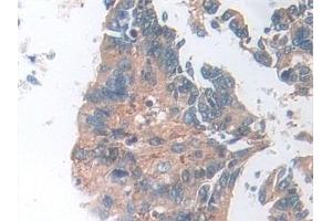 Immunohistochemistry (IHC) image for anti-Superoxide Dismutase 2, Mitochondrial (SOD2) (AA 25-222) antibody (ABIN7442672)