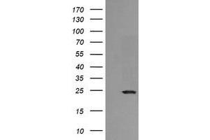 Image no. 2 for anti-RAB21, Member RAS Oncogene Family (RAB21) antibody (ABIN1500544) (RAB21 Antikörper)