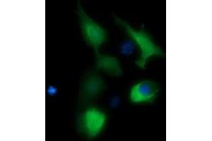 Image no. 3 for anti-butyrobetaine (Gamma), 2-Oxoglutarate Dioxygenase (Gamma-butyrobetaine Hydroxylase) 1 (BBOX1) antibody (ABIN1496815) (BBOX1 Antikörper)