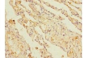 Immunohistochemistry of paraffin-embedded human lung tissue using ABIN7145856 at dilution of 1:100
