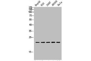 Western blot analysis of HepG2 823-AV 293T AD293 Hela lysis using PGLYRP1 antibody. (PGLYRP1 Antikörper  (Internal Region))