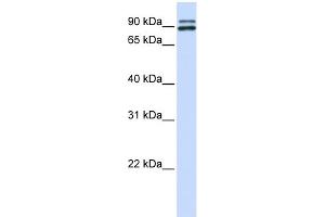 WB Suggested Anti-PCSK6 Antibody Titration: 0. (PCSK6 Antikörper  (N-Term))