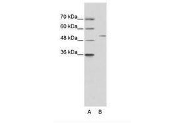 ZNF555 抗体  (AA 25-74)
