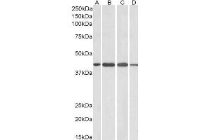 ABIN185094 (1µg/ml) staining of Human Cerebellum (A), Mouse (B), Rat (C) and Pig (D) Brain lysates (35µg protein in RIPA buffer). (ADAP1 Antikörper  (C-Term))