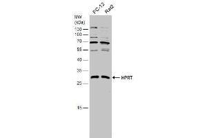 WB Image Various whole cell extracts (30 μg) were separated by 12% SDS-PAGE, and the membrane was blotted with HPRT antibody , diluted at 1:1000. (HPRT1 Antikörper)