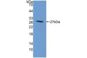 Detection of Recombinant ABCG1, Human using Polyclonal Antibody to ATP Binding Cassette Transporter G1 (ABCG1) (ABCG1 Antikörper  (AA 79-312))