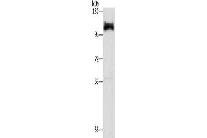 Western Blotting (WB) image for anti-Disabled Homolog 2, Mitogen-Responsive phosphoprotein (Drosophila) (DAB2) antibody (ABIN2429887) (DAB2 Antikörper)