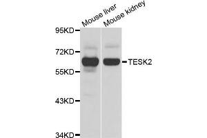 Western blot analysis of extracts of various cell lines, using TESK2 antibody (ABIN5975294) at 1/1000 dilution. (TESK2 Antikörper)