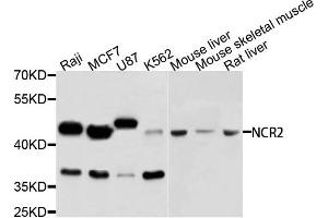 Western blot analysis of extracts of various cells, using NCR2 antibody. (NKp44/NCR2 Antikörper)