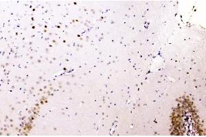 IHC analysis of hnRNP A2B1 using anti-hnRNP A2B1 antibody (ABIN5692872).