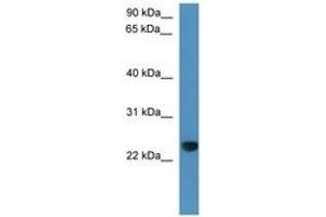 Image no. 1 for anti-Calcyphosine-Like (CAPSL) (C-Term) antibody (ABIN6746360) (CAPSL Antikörper  (C-Term))