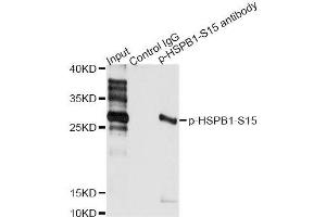 Immunoprecipitation analysis of 200 μg extracts of HeLa cells treated by EGF using 2. (HSP27 Antikörper  (pSer15))