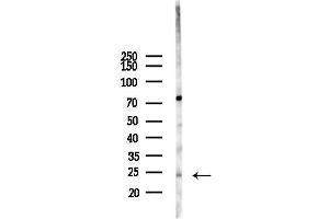 anti-Protein Phosphatase 1, Regulatory (Inhibitor) Subunit 14D (PPP1R14D) (Internal Region) antibody