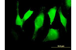 Immunofluorescence of purified MaxPab antibody to EGFR on HeLa cell. (EGFR Antikörper  (AA 1-405))
