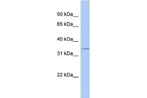 WB Suggested Anti-FITM1 Antibody Titration: 0. (FITM1 Antikörper  (Middle Region))
