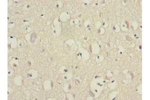 Immunohistochemistry of paraffin-embedded human brain tissue using ABIN7152155 at dilution of 1:100 (EIF3F Antikörper  (AA 88-357))