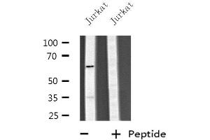 Western blot analysis of extracts from Jurkat cells, using CYP4V2 antibody. (CYP4V2 Antikörper  (Internal Region))