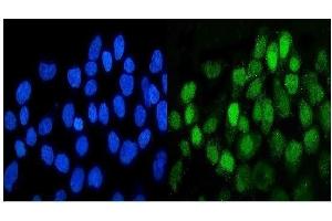 IF analysis of DDR1 using anti-DDR1 antibody (ABIN7601407). (DDR1 Antikörper  (AA 341-909))