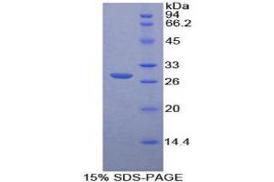 SDS-PAGE (SDS) image for Protein Tyrosine Phosphatase, Receptor Type, M (PTPRM) (AA 1197-1403) protein (His tag) (ABIN2126554) (PTPRM Protein (AA 1197-1403) (His tag))