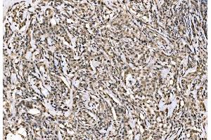 IHC analysis of WAPL/FOE using anti-WAPL/FOE antibody (ABIN7602663). (WAPAL Antikörper  (AA 916-1190))