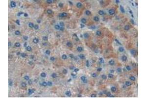 Detection of IkBd in Human Liver Tissue using Polyclonal Antibody to Inhibitory Subunit Of NF Kappa B Delta (IkBd) (IkBd Antikörper  (AA 46-285))