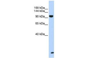 TNRC6B antibody used at 1 ug/ml to detect target protein. (TNRC6B Antikörper  (N-Term))