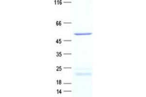 Validation with Western Blot (CAMK2D Protein (DYKDDDDK Tag))