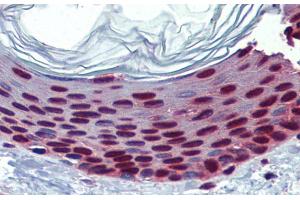 Immunohistochemistry with Human Skin lysate tissue at an antibody concentration of 5. (SLC35A5 Antikörper  (N-Term))