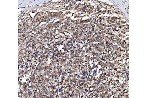 IHC analysis of NOLA1/GAR1 using anti-NOLA1/GAR1 antibody (ABIN7602076). (GAR1 Antikörper  (AA 58-165))