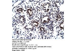 Human Lung (GABPB2 Antikörper  (C-Term))