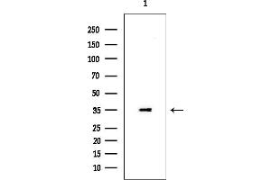 anti-Membrane-Associated Ring Finger (C3HC4) 3, E3 Ubiquitin Protein Ligase (MARCH3) (Internal Region) antibody