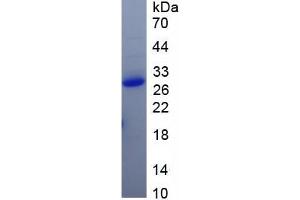 SDS-PAGE (SDS) image for SARS-CoV-2 Spike S1 protein (ABIN6952688) (SARS-CoV-2 Spike S1 Protein)