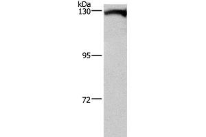 Western Blot analysis of Human testis tissue using DAAM1 Polyclonal Antibody at dilution of 1:400 (DAAM1 Antikörper)