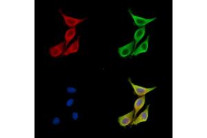 ABIN7096683 and ABIN7100748 staining HepG2 cells by IF/ICC.