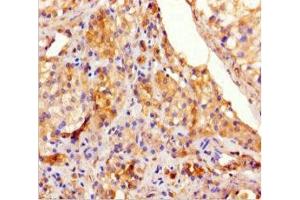 Immunohistochemistry of paraffin-embedded human testis tissue using ABIN7171822 at dilution of 1:100