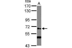 Western Blotting (WB) image for anti-UDP-N-Acetyl-alpha-D-Galactosamine:polypeptide N-Acetylgalactosaminyltransferase 14 (GalNAc-T14) (GALNT14) (AA 1-189) antibody (ABIN1498369)