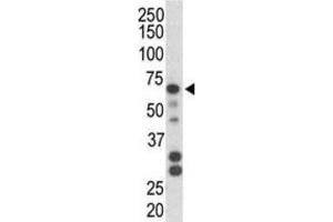 Western Blotting (WB) image for anti-Parkinson Protein 2, E3 Ubiquitin Protein Ligase (Parkin) (PARK2) antibody (ABIN3002636) (Parkin Antikörper)